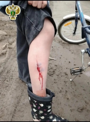 В Плесецке по иску прокурора в пользу несовершеннолетней взыскана компенсация морального вреда, причиненного вследствие укуса собаки