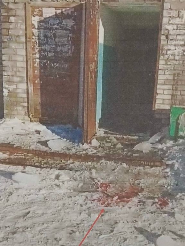 В Архангельске в суд направлено уголовное дело о падении ледяной глыбы на голову пожилого человека
