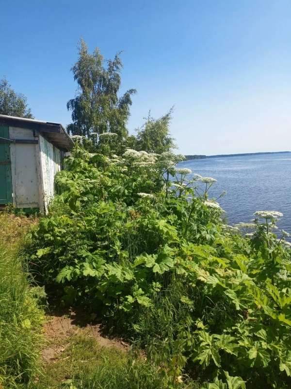 Онежский межрайонный прокурор добился взыскания компенсации морального вреда в интересах несовершеннолетнего, получившего ожоги из-за борщевика